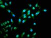 Immunofluorescence staining of Hela cells with CSB-PA024154LA01HU at 1:333, counter-stained with DAPI. The cells were fixed in 4% formaldehyde, permeabilized using 0.2% Triton X-100 and blocked in 10% normal Goat Serum. The cells were then incubated with the antibody overnight at 4°C. The secondary antibody was Alexa Fluor 488-congugated AffiniPure Goat Anti-Rabbit IgG (H+L) .