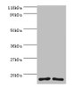 Western blot<br />
 All lanes: RPS16 protein antibody at 2µg/ml<br />
 Lane 1: 293T whole cell lysate<br />
 Lane 2: EC109 whole cell lysate<br />
 Secondary<br />
 Goat polyclonal to rabbit IgG at 1/15000 dilution<br />
 Predicted band size: 17 kDa<br />
 Observed band size: 17 kDa<br />