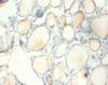 Immunohistochemistry of paraffin-embedded human thyroid tissue using CSB-PA02485A0Rb at dilution of 1:100