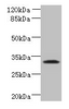 Western blot<br />
 All lanes: TSPAN5 antibody at 1.2µg/ml + Jurkat whole cell lysate<br />
 Secondary<br />
 Goat polyclonal to rabbit IgG at 1/10000 dilution<br />
 Predicted band size: 31 kDa<br />
 Observed band size: 31 kDa<br />