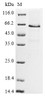 (Tris-Glycine gel) Discontinuous SDS-PAGE (reduced) with 5% enrichment gel and 15% separation gel.