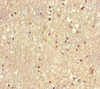 Immunohistochemistry of paraffin-embedded human brain tissue using CSB-PA025484HA01HU at dilution of 1:100