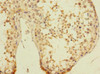 Immunohistochemistry of paraffin-embedded human testis tissue using CSB-PA025539LA01HU at dilution of 1:100