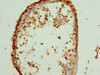 Immunohistochemistry of paraffin-embedded human testis tissue using CSB-PA02625A0Rb at dilution of 1:100