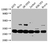 Western Blot<br />
 Positive WB detected in: A375 whole cell lysate, Hela whole cell lysate, SH-SY5Y whole cell lysate, Jurkat whole cell lysate, NIH/3T3 whole cell lysate, Mouse brain tissue<br />
 All lanes: YWHAE antibody at 3.3µg/ml<br />
 Secondary<br />
 Goat polyclonal to rabbit IgG at 1/50000 dilution<br />
 Predicted band size: 30, 27 kDa<br />
 Observed band size: 30 kDa<br />