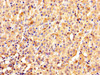 IHC image of CSB-PA026287DA01HU diluted at 1:1000 and staining in paraffin-embedded human adrenal gland tissue performed on a Leica BondTM system. After dewaxing and hydration, antigen retrieval was mediated by high pressure in a citrate buffer (pH 6.0) . Section was blocked with 10% normal goat serum 30min at RT. Then primary antibody (1% BSA) was incubated at 4°C overnight. The primary is detected by a biotinylated secondary antibody and visualized using an HRP conjugated SP system.