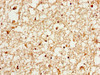 IHC image of CSB-PA026287DA01HU diluted at 1:1000 and staining in paraffin-embedded human brain tissue performed on a Leica BondTM system. After dewaxing and hydration, antigen retrieval was mediated by high pressure in a citrate buffer (pH 6.0) . Section was blocked with 10% normal goat serum 30min at RT. Then primary antibody (1% BSA) was incubated at 4°C overnight. The primary is detected by a biotinylated secondary antibody and visualized using an HRP conjugated SP system.