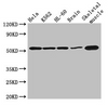 Western Blot<br />
 Positive WB detected in: Hela whole cell lysate, K562 whole cell lysate, HL60 whole cell lysate, Mouse brain tissue, Mouse skeletal muscle tissue<br />
 All lanes: ZBTB43 antibody at 3µg/ml<br />
 Secondary<br />
 Goat polyclonal to rabbit IgG at 1/50000 dilution<br />
 Predicted band size: 53 kDa<br />
 Observed band size: 53 kDa<br />