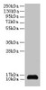 Western blot<br />
 All lanes: SNRPD2 antibody at 2µg/ml + 293T whole cell lysate<br />
 Secondary<br />
 Goat polyclonal to rabbit IgG at 1/15000 dilution<br />
 Predicted band size: 14, 13 kDa<br />
 Observed band size: 14 kDa<br />