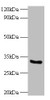 Western blot<br />
 All lanes: CYB5R3 antibody at 2µg/ml + 293T whole cell lysate<br />
 Secondary<br />
 Goat polyclonal to rabbit IgG at 1/10000 dilution<br />
 Predicted band size: 35, 32, 39 kDa<br />
 Observed band size: 32 kDa<br />