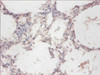 Immunohistochemistry of paraffin-embedded human lung tissue using CSB-PA02655A0Rb at dilution of 1:100