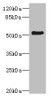 Western blot<br />
 All lanes: ZNF212 antibody at 8µg/ml + Mouse liver tissue<br />
 Secondary<br />
 Goat polyclonal to rabbit IgG at 1/10000 dilution<br />
 Predicted band size: 56 kDa<br />
 Observed band size: 56 kDa<br />