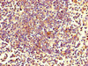 Immunohistochemistry of paraffin-embedded human spleen tissue using CSB-PA026781LA01HU at dilution of 1:100 Immunohistochemistry of paraffin-embedded human spleen tissue using CSB-PA026781LA01HU at dilution of 1:100
