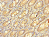 Immunohistochemistry of paraffin-embedded human small intestine tissue using CSB-PA026843LA01HU at dilution of 1:100