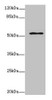 Western blot<br />
 All lanes: ZNF610 antibody at 7µg/ml + MCF-7 whole cell lysate<br />
 Secondary<br />
 Goat polyclonal to rabbit IgG at 1/10000 dilution<br />
 Predicted band size: 54, 49 kDa<br />
 Observed band size: 54 kDa<br />