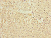 Immunohistochemistry of paraffin-embedded human adrenal gland tissue using CSB-PA027047LA01HU at dilution of 1:100 Immunohistochemistry of paraffin-embedded human adrenal gland tissue using CSB-PA027047LA01HU at dilution of 1:100