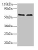 Western blot<br />
 All lanes: FUS antibody at 2µg/ml<br />
 Lane 1: 293T whole cell lysate<br />
 Lane 2: EC109 whole cell lysate<br />
 Secondary<br />
 Goat polyclonal to rabbit IgG at 1/15000 dilution<br />
 Predicted band size: 54 kDa<br />
 Observed band size: 60 kDa<br /> Western blot<br />
 All lanes: FUS antibody at 2µg/ml<br />
 Lane 1: 293T whole cell lysate<br />
 Lane 2: EC109 whole cell lysate<br />
 Secondary<br />
 Goat polyclonal to rabbit IgG at 1/15000 dilution<br />
 Predicted band size: 54 kDa<br />
 Observed band size: 60 kDa<br />