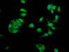 Immunofluorescence staining of MCF-7 cells with CSB-PA02775A0Rb at 1:330, counter-stained with DAPI. The cells were fixed in 4% formaldehyde, permeabilized using 0.2% Triton X-100 and blocked in 10% normal Goat Serum. The cells were then incubated with the antibody overnight at 4°C. The secondary antibody was Alexa Fluor 488-congugated AffiniPure Goat Anti-Rabbit IgG (H+L) .