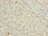 Immunohistochemistry of paraffin-embedded human liver tissue using CSB-PA03065A0Rb at dilution of 1:100