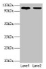 Western blot<br />
 All lanes: EXTL3 antibody at 2µg/ml<br />
 Lane 1: EC109 whole cell lysate<br />
 Lane 2: 293T whole cell lysate<br />
 Secondary<br />
 Goat polyclonal to rabbit IgG at 1/15000 dilution<br />
 Predicted bane side: 105 kDa<br />
 Observed band side: 105 kDa<br />
