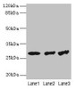 Western blot<br />
 All lanes: TBCB antibody at 4µg/ml<br />
 Lane 1: Hela whole cell lysate<br />
 Lane 2: A549 whole cell lysate<br />
 Lane 3: Jurkat whole cell lysate<br />
 Secondary<br />
 Goat polyclonal to rabbit IgG at 1/10000 dilution<br />
 Predicted band size: 28, 22 kDa<br />
 Observed band size: 28 kDa<br />