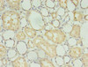 Immunohistochemistry of paraffin-embedded human kidney tissue using CSB-PA03169A0Rb at dilution of 1:100