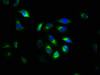 Immunofluorescence staining of A549 cells with CSB-PA03179A0Rb at 1:533, counter-stained with DAPI. The cells were fixed in 4% formaldehyde, permeabilized using 0.2% Triton X-100 and blocked in 10% normal Goat Serum. The cells were then incubated with the antibody overnight at 4°C. The secondary antibody was Alexa Fluor 488-congugated AffiniPure Goat Anti-Rabbit IgG (H+L) .