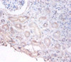 Immunohistochemistry of paraffin-embedded human kidney tissue using CSB-PA03255A0Rb at dilution of 1:100