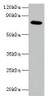 Western blot<br />
 All lanes: ARPC3 antibody at 2µg/ml + 293T whole cell lysate<br />
 Secondary<br />
 Goat polyclonal to rabbit IgG at 1/15000 dilution<br />
 Predicted band size: 21 kDa<br />
 Observed band size: 75 kDa<br />