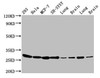 Western Blot<br />
 Positive WB detected in: 293 whole cell lysate, Hela whole cell lysate, MCF-7 whole cell lysate, SH-SY5Y whole cell lysate, Rat lung tissue, Rat brain tissue, Mouse lung tissue, Mouse brain tissue<br />
 All lanes: BCAP31 antibody at 4.8µg/ml<br />
 Secondary<br />
 Goat polyclonal to rabbit IgG at 1/50000 dilution<br />
 Predicted band size: 28, 35 kDa<br />
 Observed band size: 28 kDa<br />