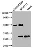 Immunoprecipitating BCAP31 in Mouse liver tissue<br />
 Lane 1: Rabbit control IgG (1µg) instead of CSB-PA03425A0Rb in Mouse liver tissue.
 For western blotting, a HRP-conjugated Protein G antibody was used as the secondary antibody (1/2000) <br />
 Lane 2: CSB-PA03425A0Rb (6µg) + Mouse liver tissue (500µg) <br />
 Lane 3: Mouse liver tissue (10µg) <br />