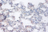 Immunohistochemistry of paraffin-embedded human lung tissue using CSB-PA03465A0Rb at dilution of 1:100