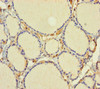 Immunohistochemistry of paraffin-embedded human thyroid tissue using CSB-PA03474A0Rb at dilution of 1:100