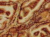 IHC image of CSB-PA03484A0Rb diluted at 1:1200 and staining in paraffin-embedded human prostate tissue performed on a Leica BondTM system. After dewaxing and hydration, antigen retrieval was mediated by high pressure in a citrate buffer (pH 6.0) . Section was blocked with 10% normal goat serum 30min at RT. Then primary antibody (1% BSA) was incubated at 4°C overnight. The primary is detected by a biotinylated secondary antibody and visualized using an HRP conjugated SP system.