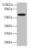 Western blot<br />
 All lanes: GABARAPL2 antibody at 2µg/ml + EC109 whole cell lysate<br />
 Secondary<br />
 Goat polyclonal to rabbit IgG at 1/15000 dilution<br />
 Predicted band size: 14 kDa<br />
 Observed band size: 60 kDa<br />