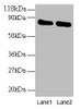 Western blot<br />
 All lanes: OTUB1 antibody at 2µg/ml<br />
 Lane 1: EC109 whole cell lysate<br />
 Lane 2: 293T whole cell lysate<br />
 Secondary<br />
 Goat polyclonal to rabbit IgG at 1/15000 dilution<br />
 Predicted band size: 32, 36 kDa<br />
 Observed band size: 80 kDa<br />
