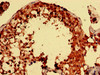 Immunohistochemistry analysis of human testis tissue using CSB-PA03729A0Rb at dilution of 1:100