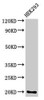 Western Blot<br />
 Positive WB detected in: HEK293 whole cell lysate<br />
 All lanes: PARK7 antibody at 3.4µg/ml<br />
 Secondary<br />
 Goat polyclonal to rabbit IgG at 1/50000 dilution<br />
 Predicted band size: 20 kDa<br />
 Observed band size: 20 kDa<br />