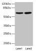 Western Blot<br />
 All lanes: NELFB antibody at 2µg/ml<br />
 Lane 1: NIH/3T3 whole cell lysate<br />
 Lane 2: HL60 whole cell lysate<br />
 Secondary<br />
 Goat polyclonal to rabbit IgG at 1/15000 dilution<br />
 Predicted band size: 66 kDa<br />
 Observed band size: 66 kDa<br />