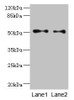 Western blot<br />
 All lanes: TUBB3 antibody at 6µg/ml<br />
 Lane 1: A549 whole cell lysate<br />
 Lane 2: A431 whole cell lysate<br />
 Secondary<br />
 Goat polyclonal to rabbit IgG at 1/10000 dilution<br />
 Predicted band size: 51, 43 kDa<br />
 Observed band size: 51 kDa<br />