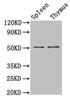 Western Blot<br />
 Positive WB detected in: Mouse spleen tissue, Mouse thymus tissue<br />
 All lanes: TUBB3 antibody at 1.5µg/ml<br />
 Secondary<br />
 Goat polyclonal to rabbit IgG at 1/50000 dilution<br />
 Predicted band size: 51, 43 kDa<br />
 Observed band size: 51 kDa<br />