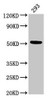 Western Blot<br />
 Positive WB detected in: 293 whole cell lysate<br />
 All lanes: TUBB3 antibody at 3µg/ml<br />
 Secondary<br />
 Goat polyclonal to rabbit IgG at 1/50000 dilution<br />
 Predicted band size: 51, 43 kDa<br />
 Observed band size: 51 kDa<br />