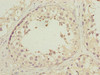 Immunohistochemistry of paraffin-embedded human testis tissue using CSB-PA03934A0Rb at dilution of 1:100
