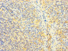 Immunohistochemistry of paraffin-embedded human tonsil tissue using CSB-PA04059A0Rb at dilution of 1:100