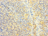 Immunohistochemistry of paraffin-embedded human tonsil tissue using CSB-PA04059A0Rb at dilution of 1:100