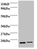 Western blot<br />
 All lanes: Profilin-1 antibody at 2µg/ml<br />
 Lane 1: EC109 whole cell lysate<br />
 Lane 2: 293T whole cell lysate<br />
 Secondary<br />
 Goat polyclonal to rabbit IgG at 1/15000 dilution<br />
 Predicted band size: 16 kDa<br />
 Observed band size: 16 kDa<br />