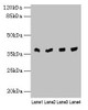 Western blot<br />
 All lanes: TALDO1 antibody at 0.1µg/ml<br />
 Lane 1: Human placenta tissue<br />
 Lane 2: Hela whole cell lysate<br />
 Lane 3: Jurkat whole cell lysate<br />
 Lane 4: A375 whole cell lysate<br />
 Secondary<br />
 Goat polyclonal to rabbit IgG at 1/10000 dilution<br />
 Predicted band size: 38 kDa<br />
 Observed band size: 38 kDa<br />