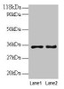 Western blot<br />
 All lanes: PTDSS1 antibody at 2µg/ml<br />
 Lane 1: EC109 whole cell lysate<br />
 Lane 2: 293T whole cell lysate<br />
 Secondary<br />
 Goat polyclonal to rabbit IgG at 1/15000 dilution<br />
 Predicted band size: 56, 39, 35 kDa<br />
 Observed band size: 35 kDa<br />