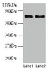 Western blot<br />
 All lanes: TAX1BP3 antibody at 2µg/ml<br />
 Lane 1: EC109 whole cell lysate<br />
 Lane 2: 293T whole cell lysate<br />
 Secondary<br />
 Goat polyclonal to rabbit IgG at 1/15000 dilution<br />
 Predicted band size: 14 kDa<br />
 Observed band size: 70 kDa<br />