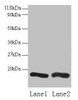 Western blot<br />
 All lanes: CHMP2A antibody at 2µg/ml<br />
 Lane 1: EC109 whole cell lysate<br />
 Lane 2: 293T whole cell lysate<br />
 Secondary<br />
 Goat polyclonal to rabbit IgG at 1/15000 dilution<br />
 Predicted band size: 26 kDa<br />
 Observed band size: 16 kDa<br />